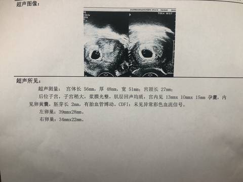 journal_insert_pic_1202589742