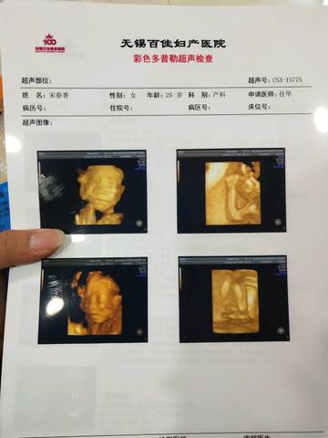 journal_insert_pic_1203783228