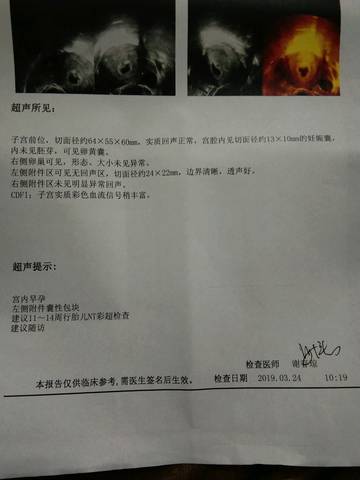 journal_insert_pic_1203731193