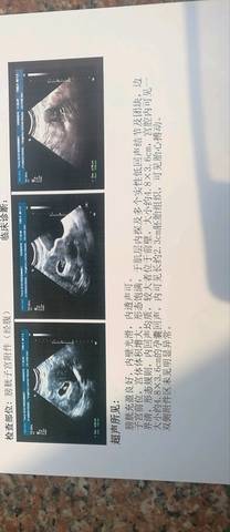 journal_insert_pic_1203791826