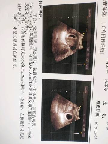 journal_insert_pic_1204278300