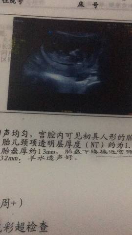 journal_insert_pic_1204174827