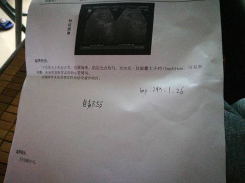 journal_insert_pic_1204289519