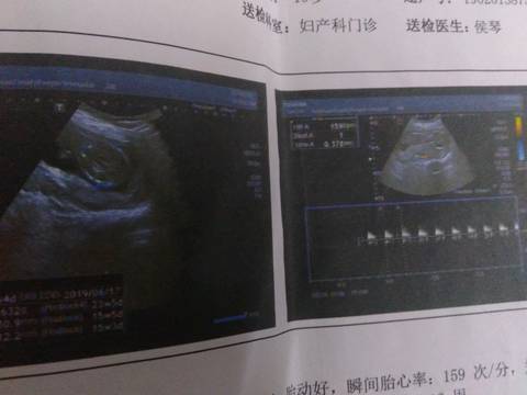 journal_insert_pic_1207320429