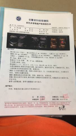 journal_insert_pic_1209467732