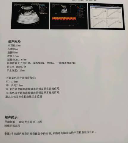 journal_insert_pic_1210260884
