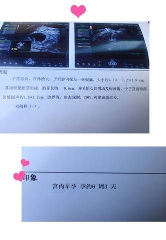 journal_insert_pic_1214213128