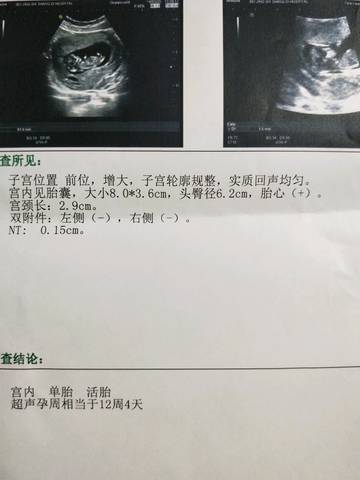 journal_insert_pic_1215536154