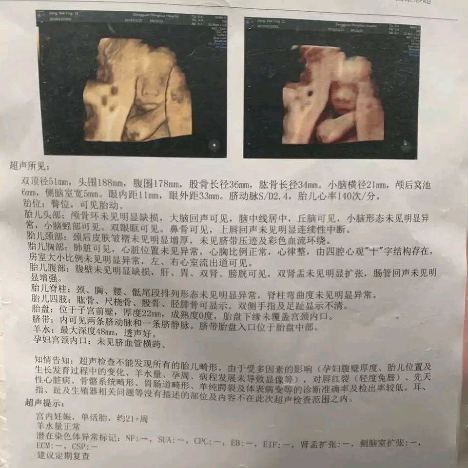 四维有人会看吗