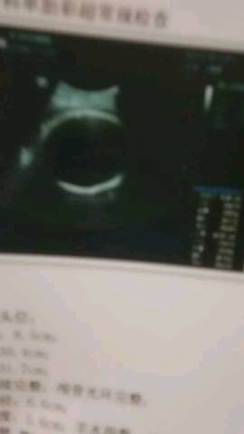 journal_insert_pic_1216510168