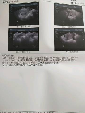 journal_insert_pic_1216990145