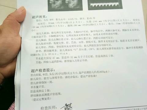 journal_insert_pic_1217788175