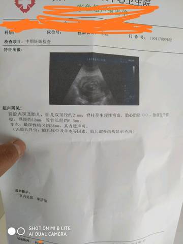 journal_insert_pic_1218416900