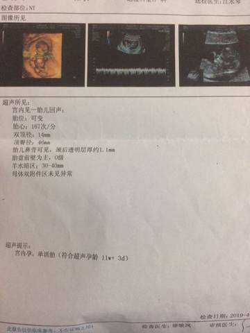 journal_insert_pic_1218545659