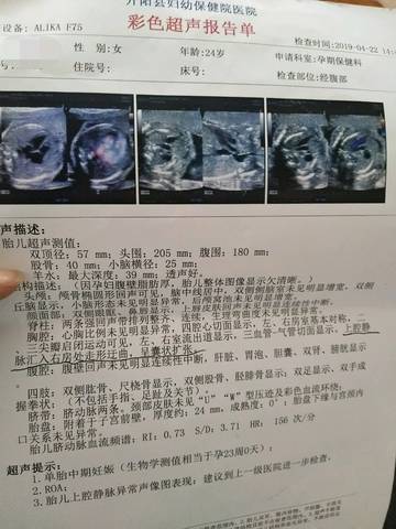 journal_insert_pic_1222051307
