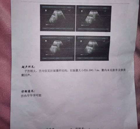 journal_insert_pic_1222566615