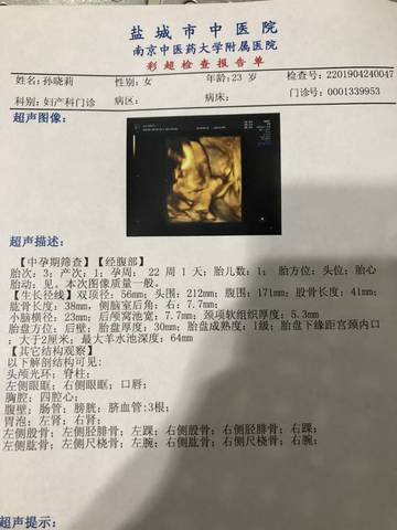 journal_insert_pic_1222748950