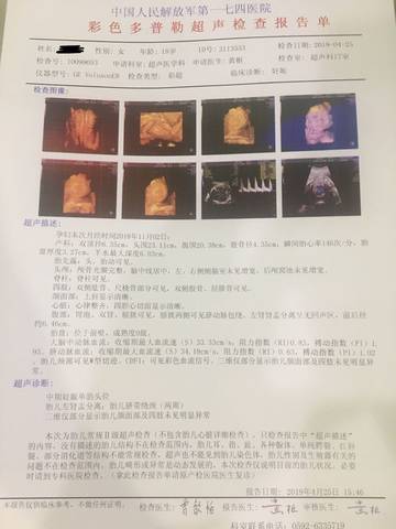 journal_insert_pic_1223890574