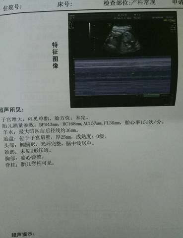 journal_insert_pic_1226269895