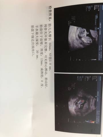 journal_insert_pic_1227023346