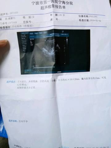 journal_insert_pic_1228521614