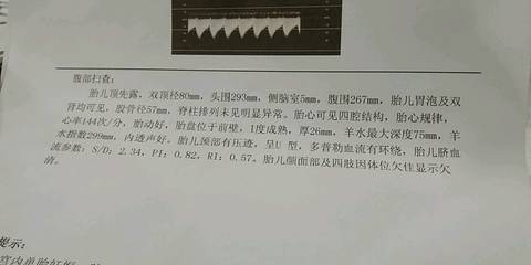 journal_insert_pic_1228373849