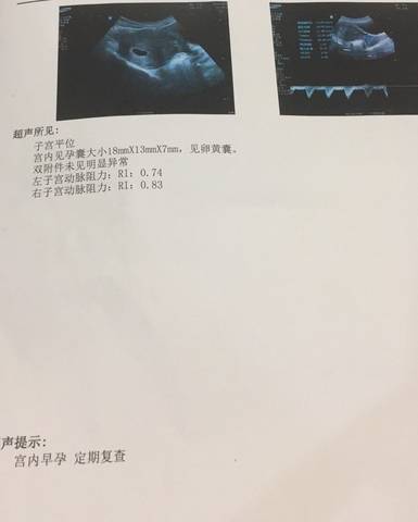 journal_insert_pic_1228783871