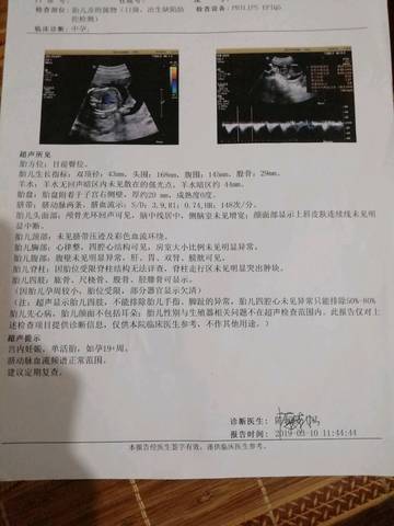journal_insert_pic_1229668541