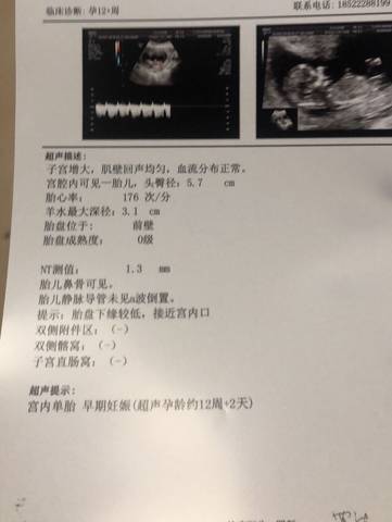journal_insert_pic_1229824993