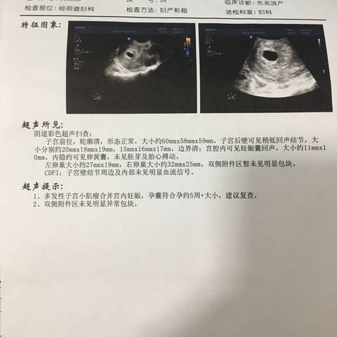journal_insert_pic_1230545925
