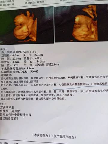 journal_insert_pic_1230507844