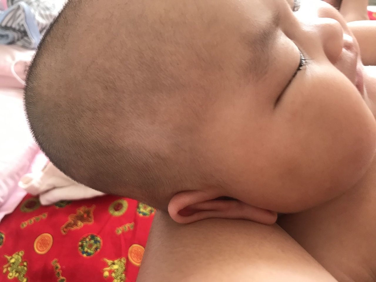 有宝妈知道这白斑是什么嘛，好几天了还不下去？急急急