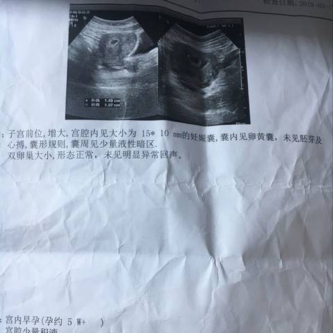journal_insert_pic_1231903506