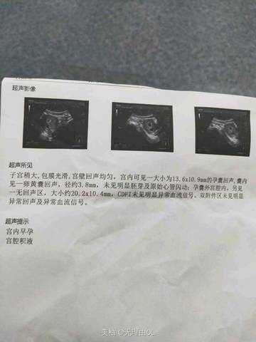 journal_insert_pic_1232057037