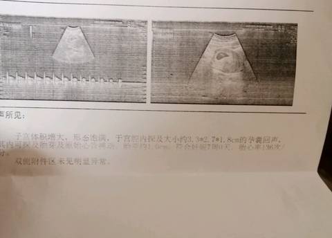 journal_insert_pic_1231727441