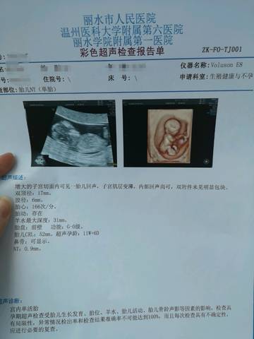 journal_insert_pic_1233866458