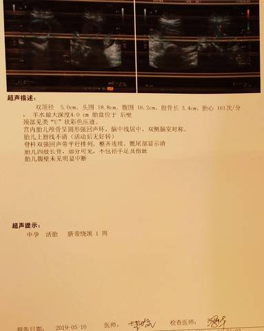 journal_insert_pic_1233478362