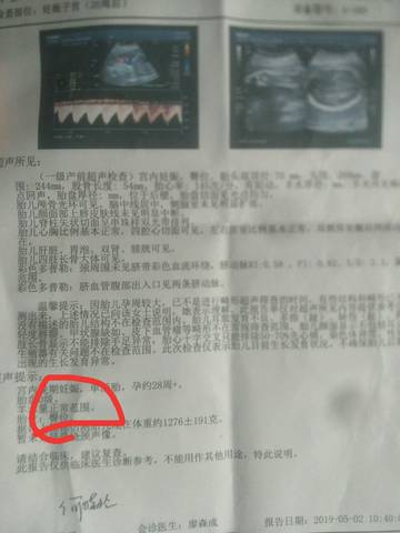 journal_insert_pic_1234145987