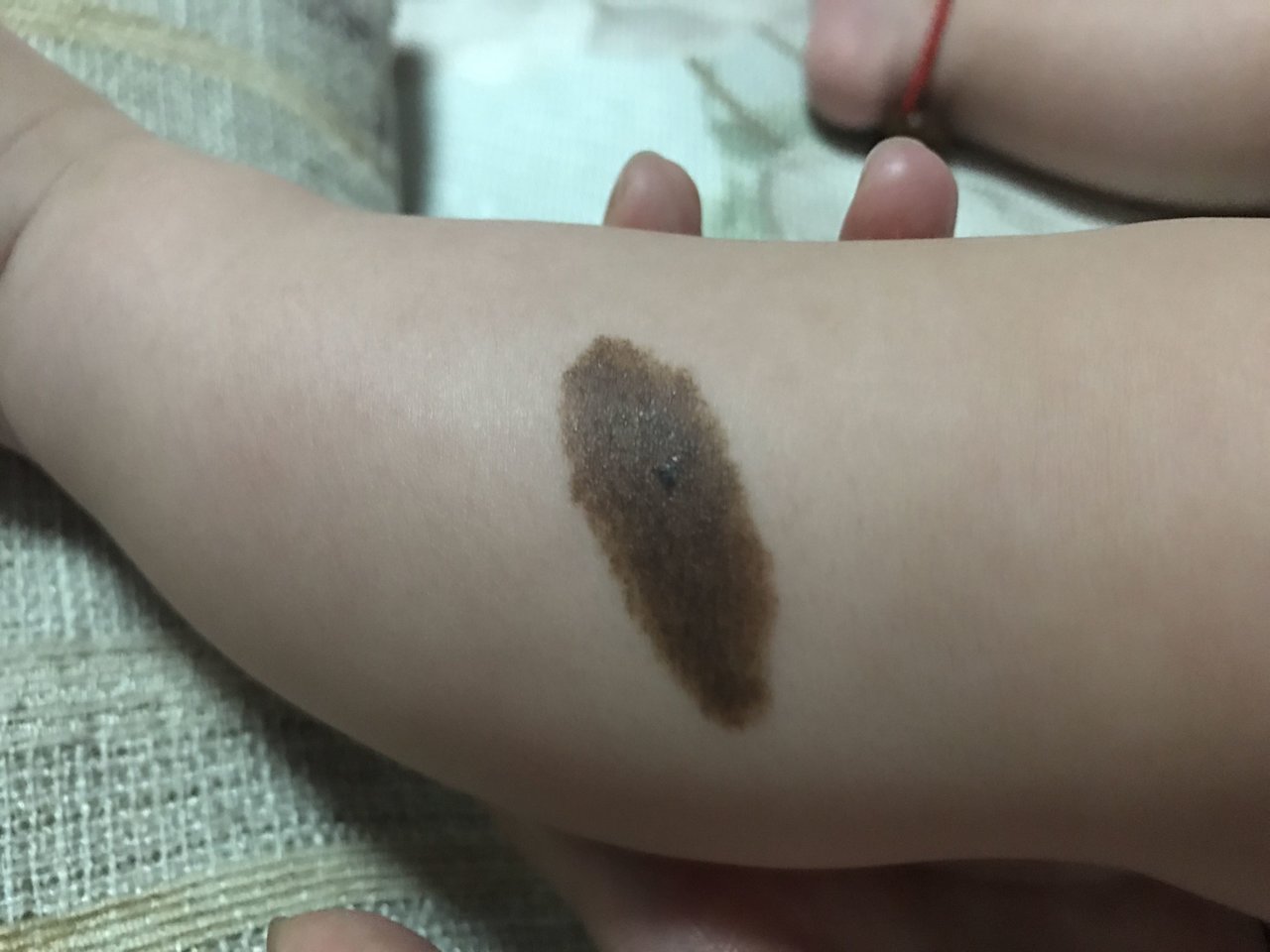棕色胎记