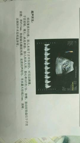 journal_insert_pic_1234260917