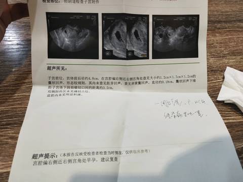 journal_insert_pic_1234280227