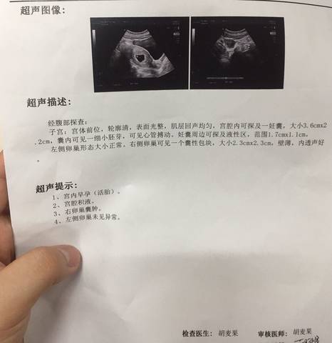 journal_insert_pic_1235148579