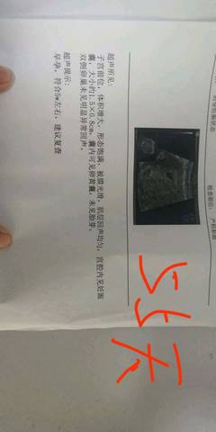 journal_insert_pic_1235713886