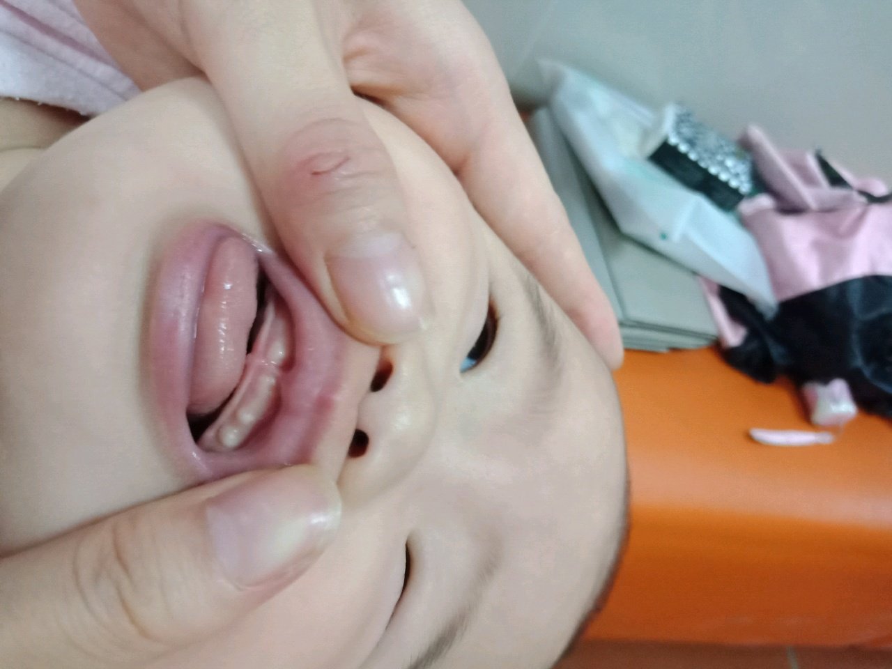 宝宝嘴里那个白色的是什么对宝宝有影响吗？急
