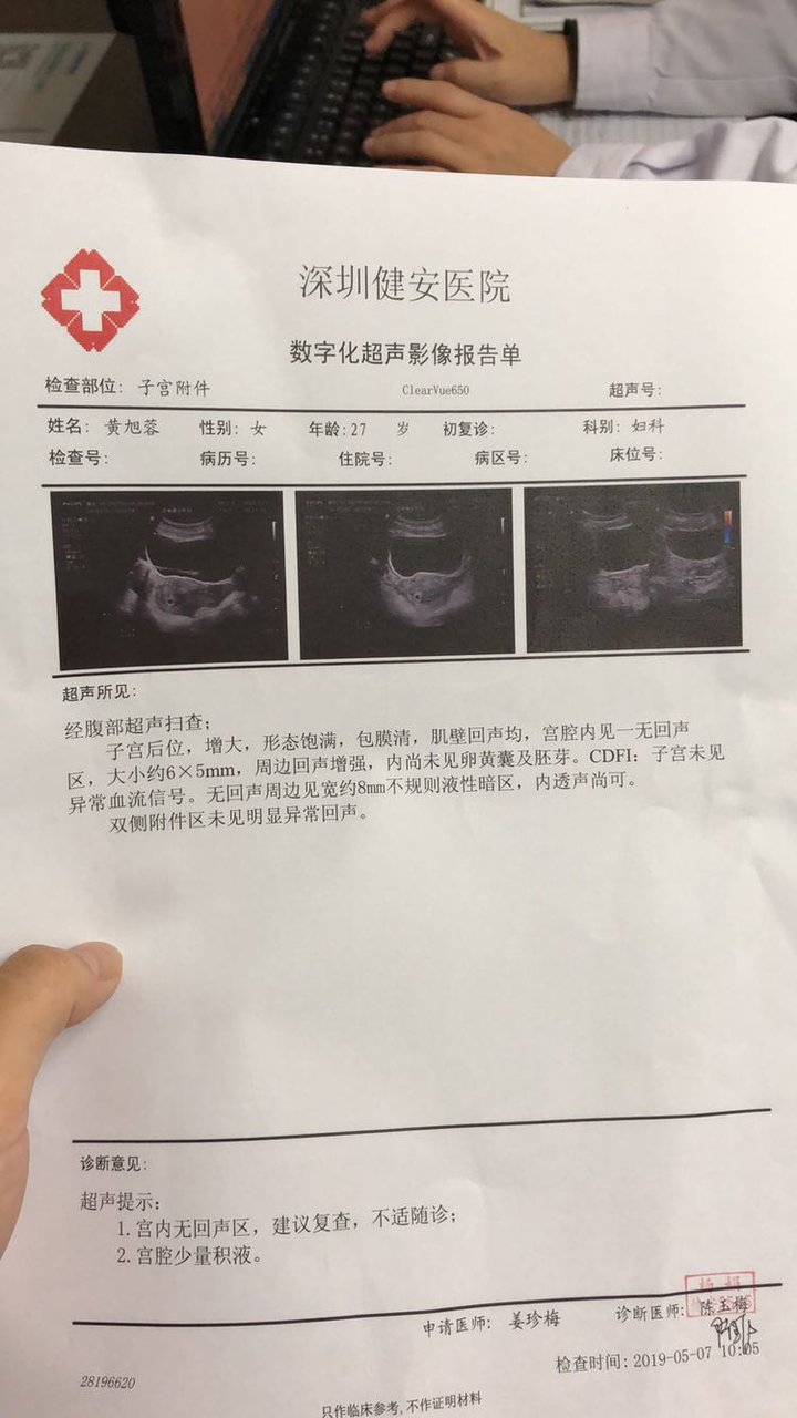 盆腔积液20mm了
