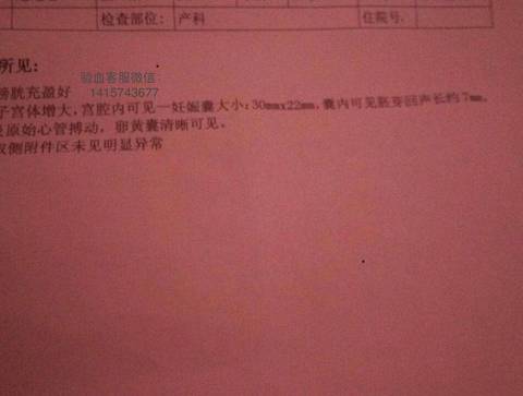 journal_insert_pic_1238538417