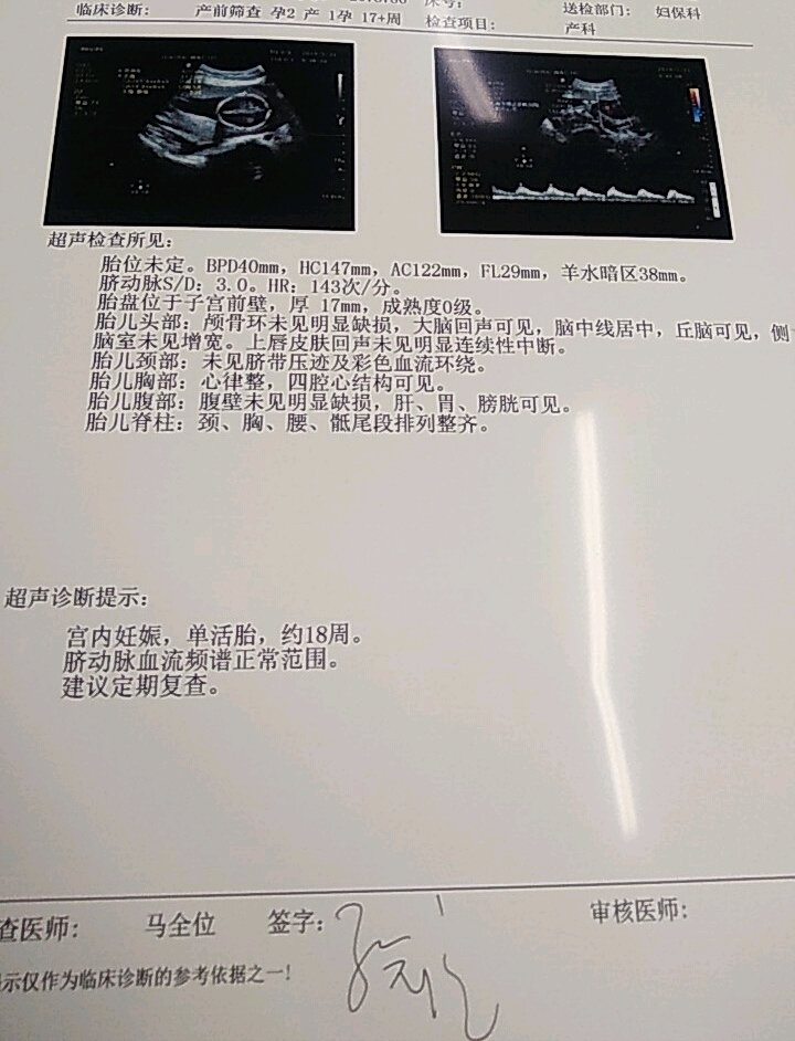 能分出男女了吗？誰能告诉我