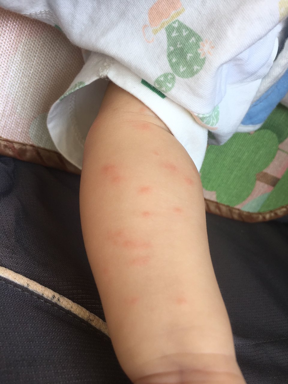 右手上起红点