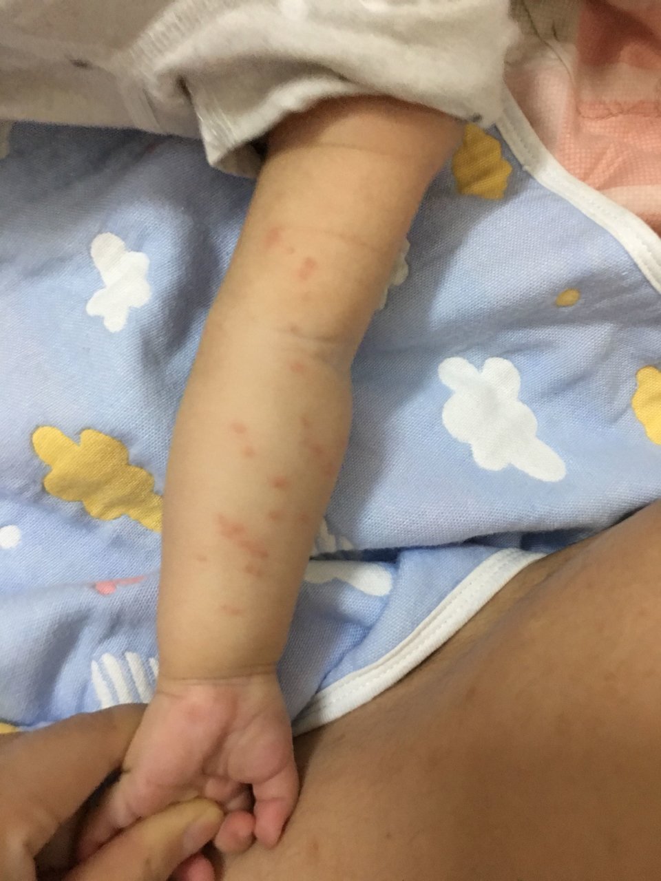 右手上起红点