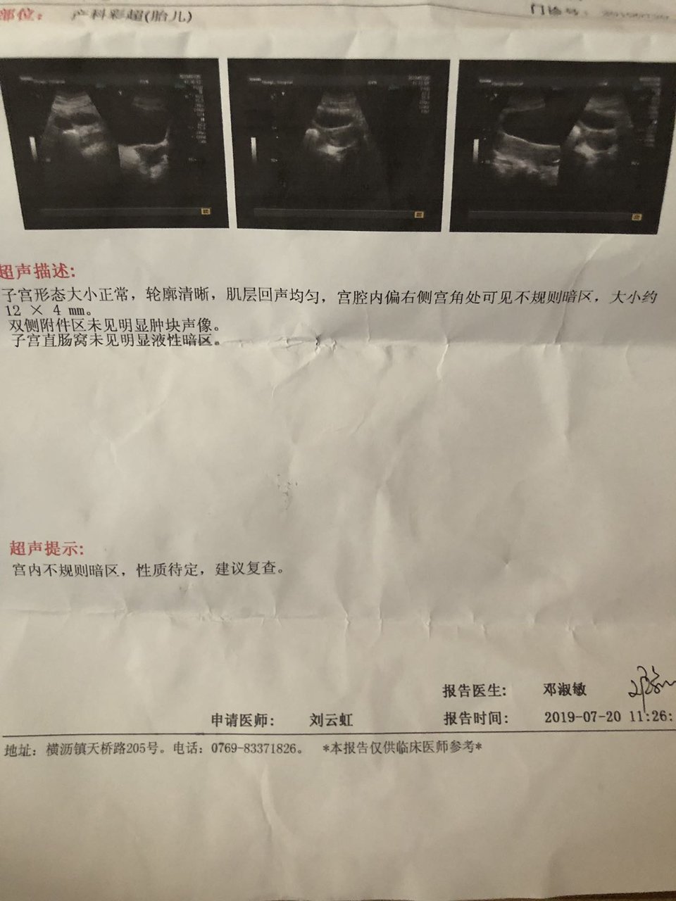 我是不是假怀孕了？